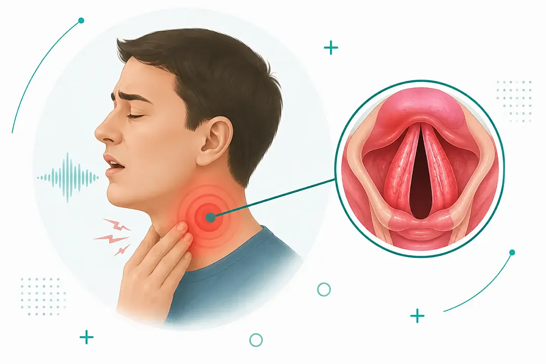 Laryngitis